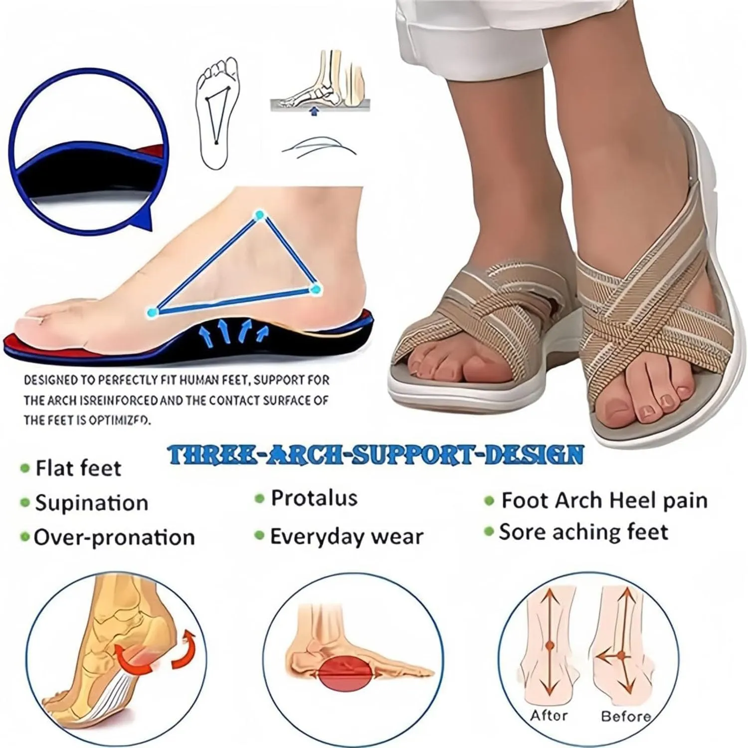 Orthopedic sandals, upgraded shock-absorbing sole sandals, elastic lightweight orthopedic open-toe sandals